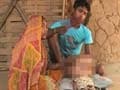 Eighteen-month-old Tripura girl suffers with swollen head, parents say she needs 'miracle'