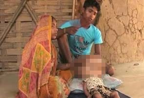 Eighteen-month-old Tripura girl suffers with swollen head, parents say she needs 'miracle'