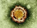 WHO reports first patient-to-nurse spread of new SARS-like virus