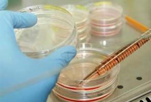 Scientists create human stem cells through cloning