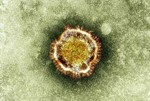 France confirms first case of new SARS-related virus 