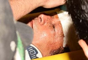 Imran Khan suffers head injury after fall from lift at Lahore rally
