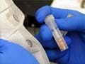 MERS virus death toll hits 33: World Health Organization