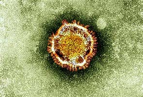 Saudi Arabia: one more death from new virus 