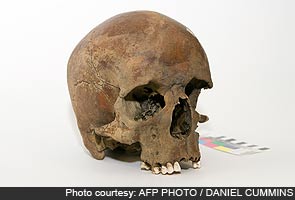 White man's skull has Australians scratching heads