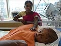 Indian doctors discharge baby with swollen head