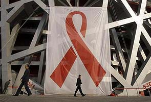 Gene discovery could lead to new types of HIV treatments