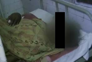 Girl set on fire allegedly by three men in Moradabad in Uttar Pradesh