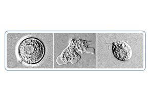 Brain-eating amoeba rattles nerves in Louisiana