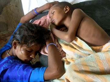 Two more children die due to encephalitis in Uttar Pradesh, toll rises to 497