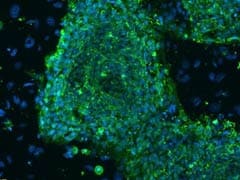 Scientists create embryonic-type stem cells without embryos