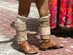 India to provide Artificial Limbs to 1000 People in Afghanistan