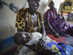 13 Dead in Cholera Outbreak in South Sudan: United Nations