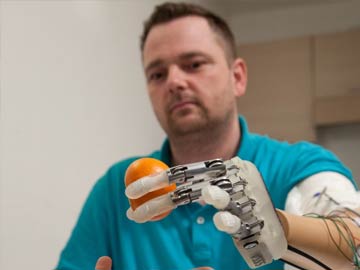 Advanced Prosthetic Arm Approved for US Market