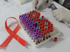 Middle East Sees 'Worrying' Rise in HIV Cases: United Nations
