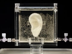 German Museum Shows Live Replica of Van Gogh's Ear
