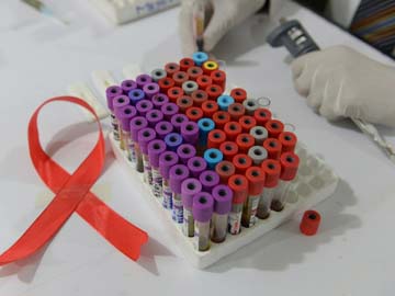 AIDS Deaths up in Russia, Against Global Trend 