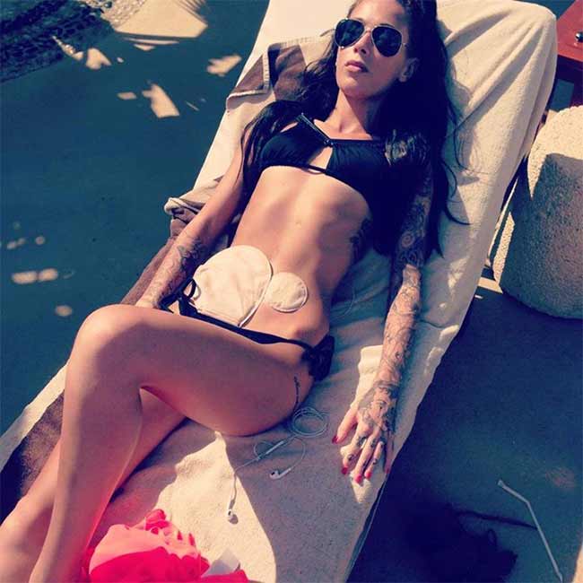This Woman With Crohn's Posted A Selfie Of Her Ileostomy Bag, And