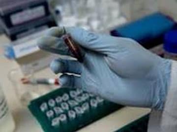 Swine Flu Claims 12 Lives in Kerala