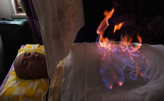 Burn, Patient, Burn: Medical Inferno in China 