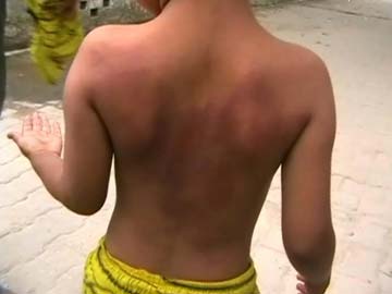 Ghaziabad: 6-Year-Old Allegedly Beaten by Teacher For Not Doing Homework