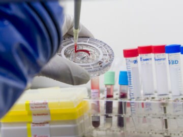 Canada's Immunovaccine Inc Says Test of Ebola Vaccine Promising