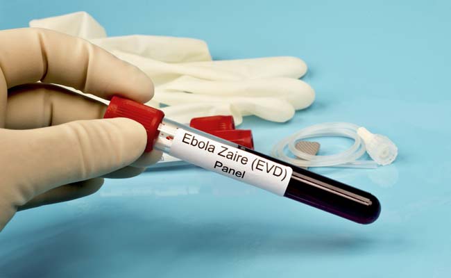 UN's Ebola Pointman in Guinea Dies