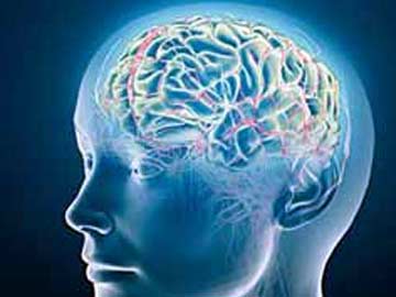 University Says It Can Account for Missing Brains