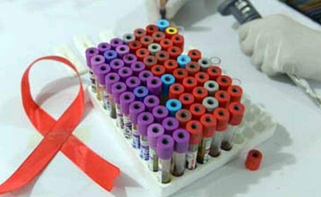 Tiny DNA 'machine' could cut HIV diagnosis cost