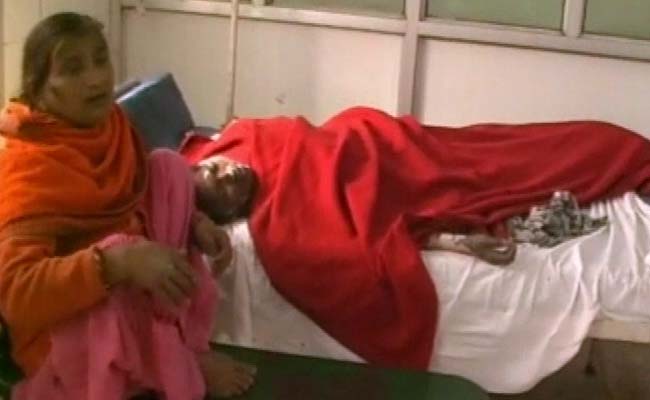 Set on Fire, Woman Battles For life in Varanasi