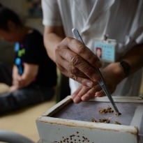 Bee Sting Therapy to Cure Cancer, Arthritis in China