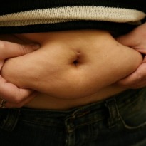 Expanding Waistline for Women 'is a Predictor for Breast Cancer Risk'