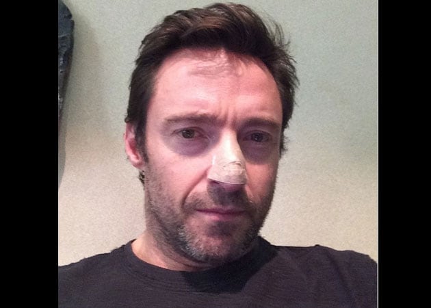Hugh Jackman treated for skin cancer, urges fans to use sunscreen