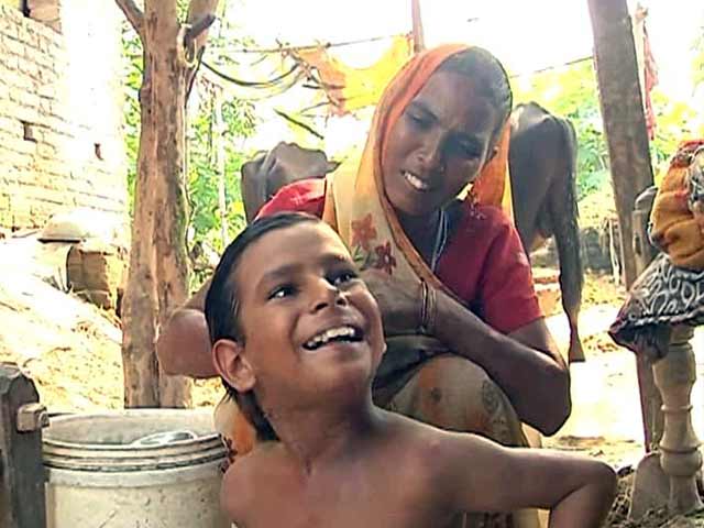Video : 15 children die of encephalitis in Uttar Pradesh, toll reaches 271 this year