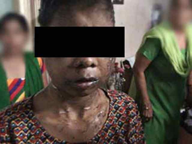 Beaten with dog chain, forced to drink urine: teen rescued from Delhi home