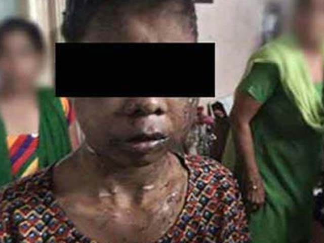 'I want to be a teacher,' says teen help, rescued from South Delhi home after torture