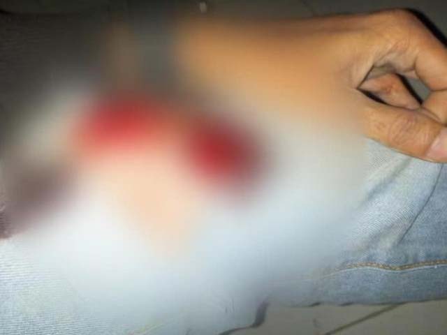 Gay man alleges sexual assault by two Ahmedabad policemen