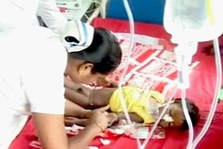 बिहार में इंसेफलाइटिस का शिकार बनते बच्चे बिहार में इंसेफलाइटिस का शिकार बनते बच्चे