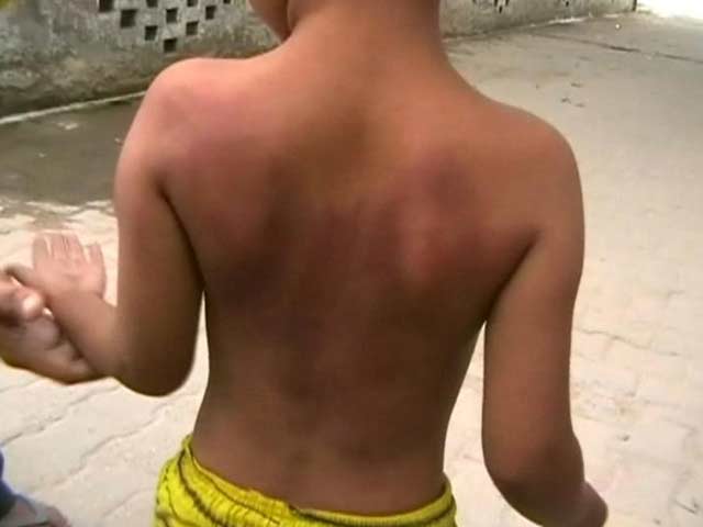Video : 6-Year-Old Allegedly Beaten by Teacher For Not Doing Homework