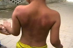 6-Year-Old Allegedly Beaten by Teacher For Not Doing Homework 6-Year-Old Allegedly Beaten by Teacher For Not Doing Homework