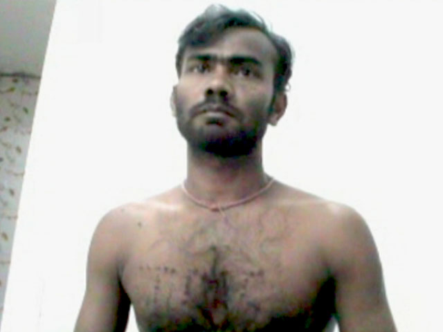 बीजेपी कार्यकर्ता को सिगरेट से दागा