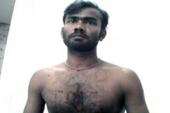 BJP Worker Burned With Cigarette Butts for 'Attending Amit Shah's Kolkata Rally' BJP Worker Burned With Cigarette Butts for 'Attending Amit Shah's Kolkata Rally'