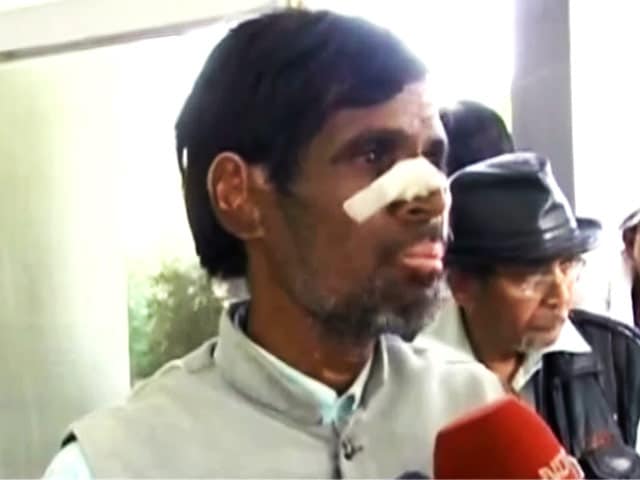 Videos : क्यों काट दी गई दलित की नाक?