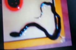 Snakes in Operation Theatre Had Surgeon Running in Andhra Hospital Snakes in Operation Theatre Had Surgeon Running in Andhra Hospital