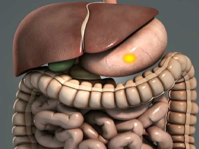 How Does a Person Become Diabetic?