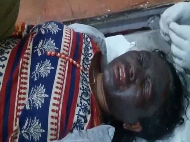 Tribal Activist Soni Sori Attacked With 'Acid-Like Chemical' In Chhattisgarh