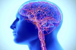 Stroke: A Medical Emergency Stroke: A Medical Emergency