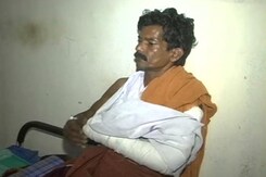 'Don't Stop Fireworks,' Say Those Injured In Fire At Kerala's Kollam 'Don't Stop Fireworks,' Say Those Injured In Fire At Kerala's Kollam