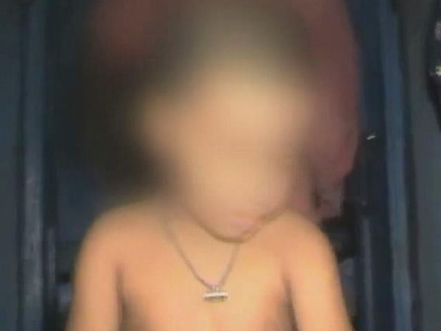 Three-And-A-Half-Year-Old Bears Brunt Of Poll Violence In Bengal