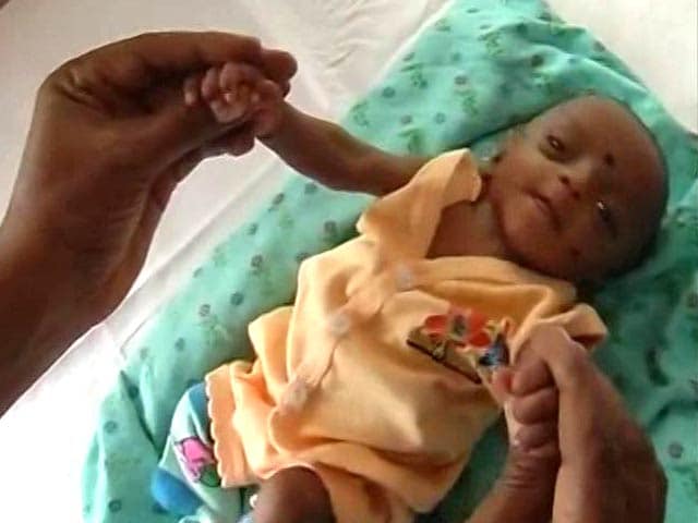 Video : This Preemie Weighed As Much As A Cellphone. Then This Happened